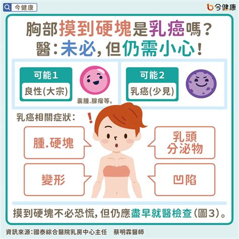 胸部長痣乳癌|認識乳癌：乳癌風險、成因、症狀與預防